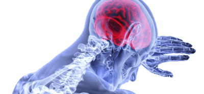 brain injury